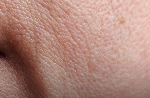 3 Sudirgusi veido oda