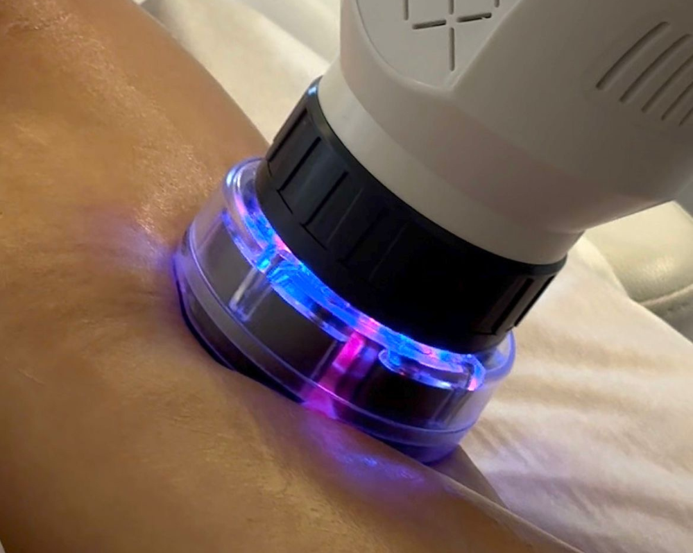 Kūno kontūravimas Core Sculpt aparatu