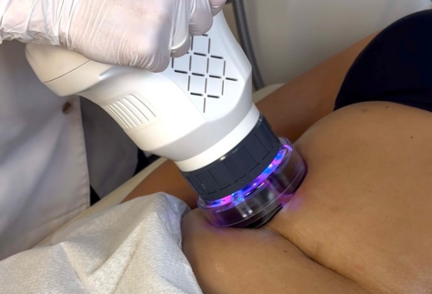 New Lipoderm aparatas